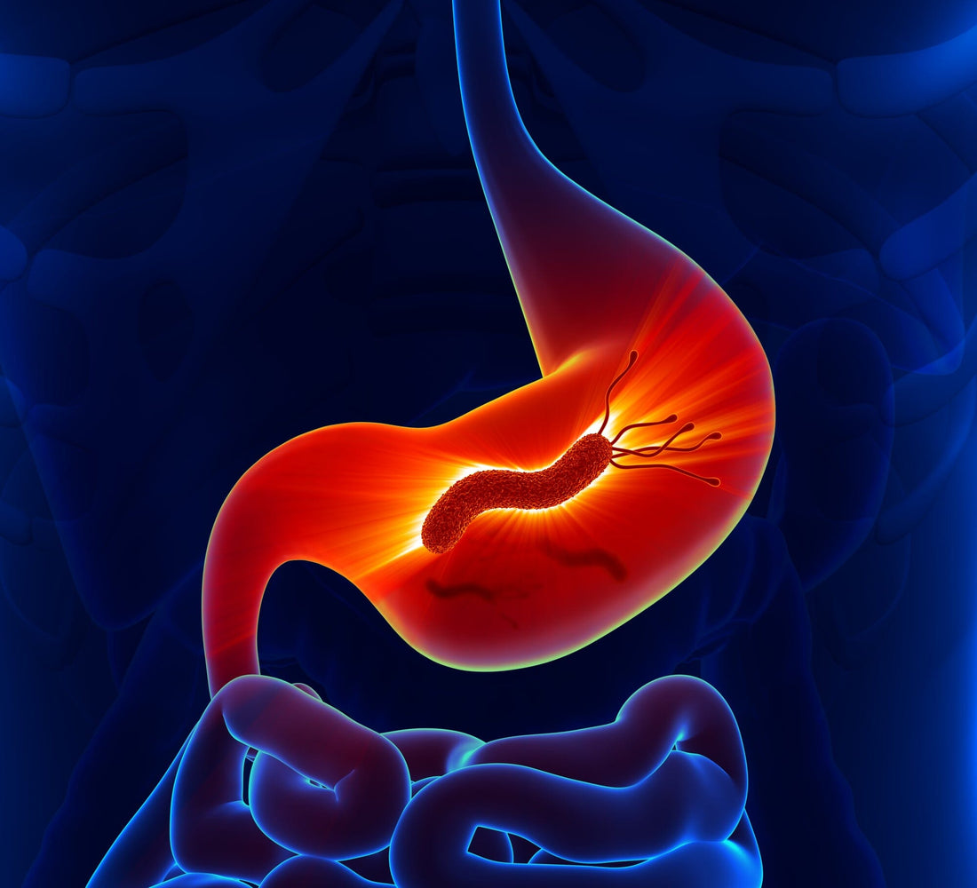 4 Ways To Test For H Pylori